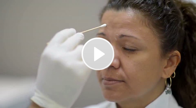 BOTOX: Arrugas de expresión facial - Explicación del tratamiento - Clínica Dr. Badiola