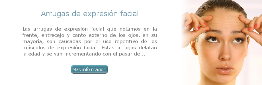 Arrugas de expresión facial
